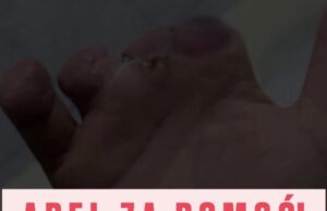 Апел за помоћ нашем младом суграђанину